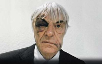 Ecclestone uses mugging bruises for sponsor advert
